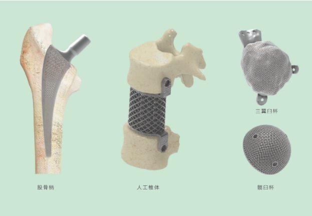 三維打印髖關(guān)節(jié)技術(shù)新動(dòng)態(tài)，重塑生活的科技魔法奇跡